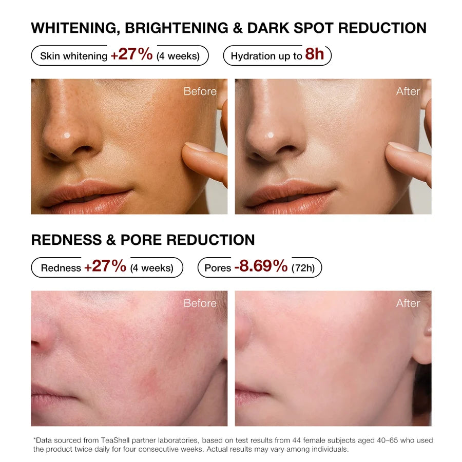 Teashell Niacinamide Brightening Serum | Buy 1 Get 1 FREE