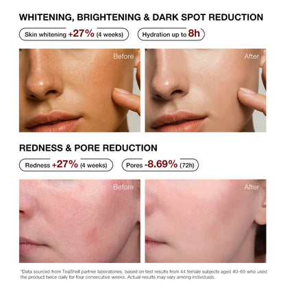 Teashell Niacinamide Brightening Serum | Buy 1 Get 1 FREE