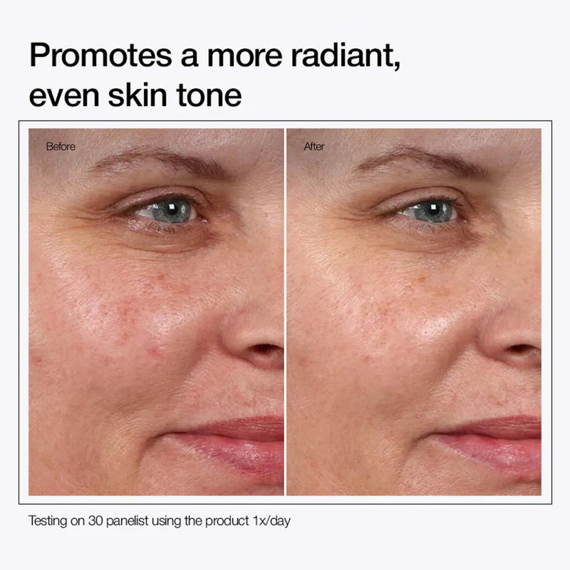 Urapra Glycolic Acid 7% Toning Solution 200ml – Buy 1 Get 1 Free | Brightening & Skin Refining Toner