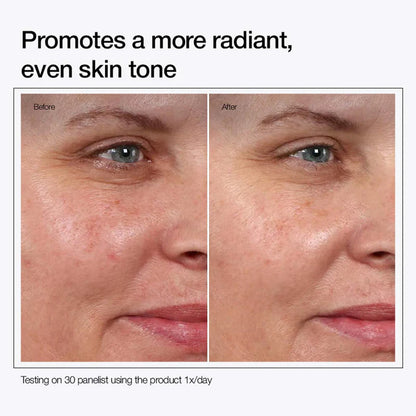 Urapra Glycolic Acid 7% Toning Solution 200ml – Buy 1 Get 1 Free | Brightening & Skin Refining Toner