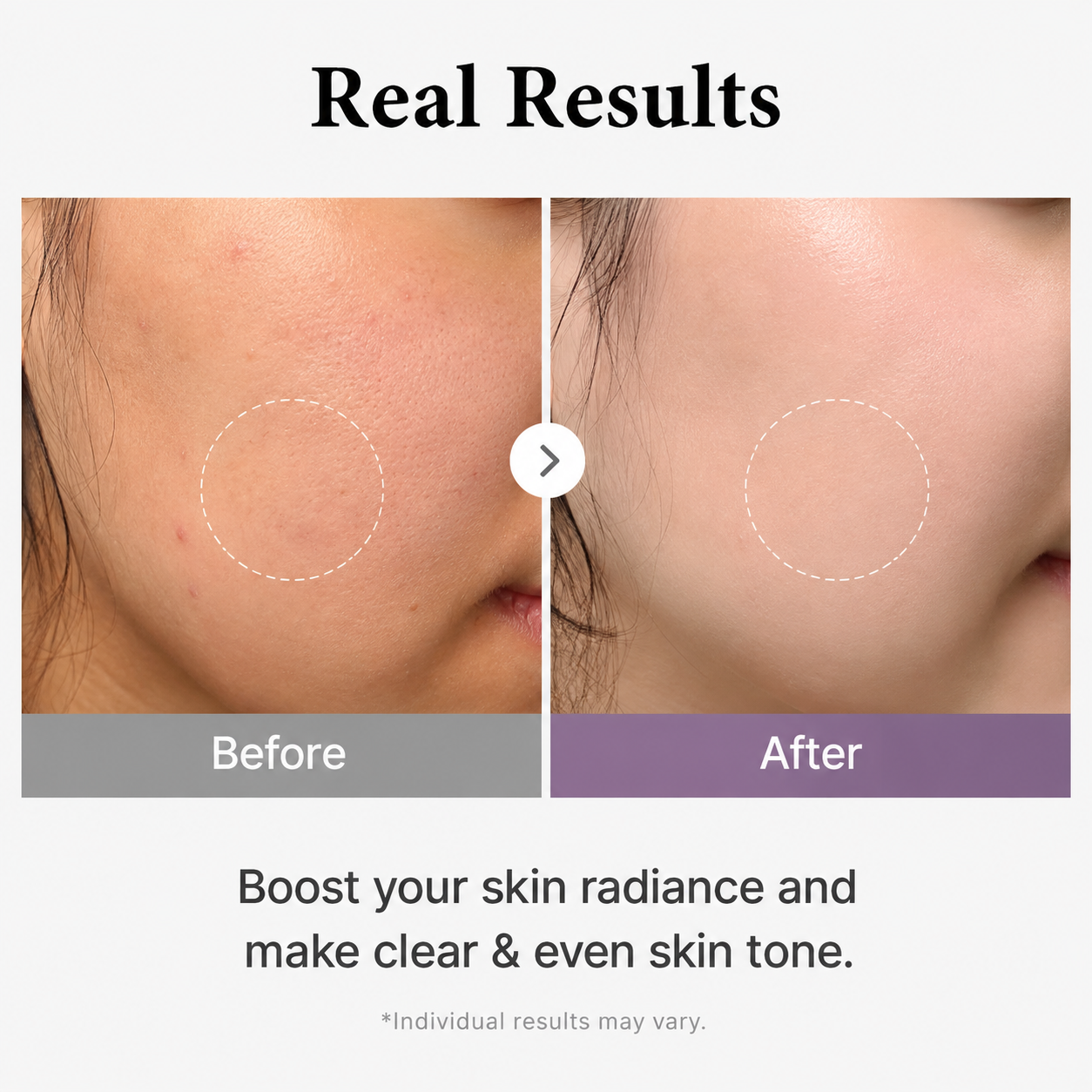 Medicube AGE-R Glutathione Glow Toner 140ml – Radiant & Even Skin Tone