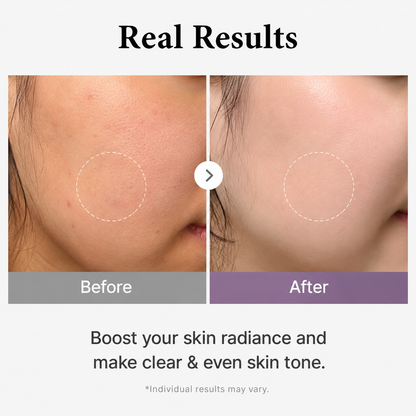 Medicube AGE-R Glutathione Glow Toner 140ml – Radiant & Even Skin Tone