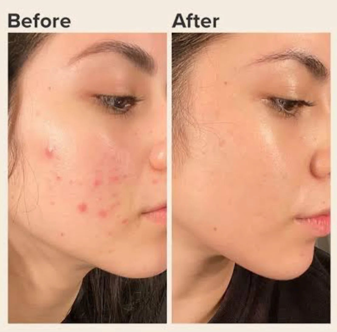Zafrani Glow Gold Serum Cream | Buy 1 Get 1 FREE | 100% Organic
