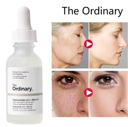 The Skin Support Set (Niacinamide + Hyaluronic Serum)