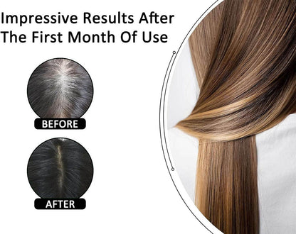 Rosemary & Rice Water Hair Growth Spray - Buy 1 Get 1 FREE