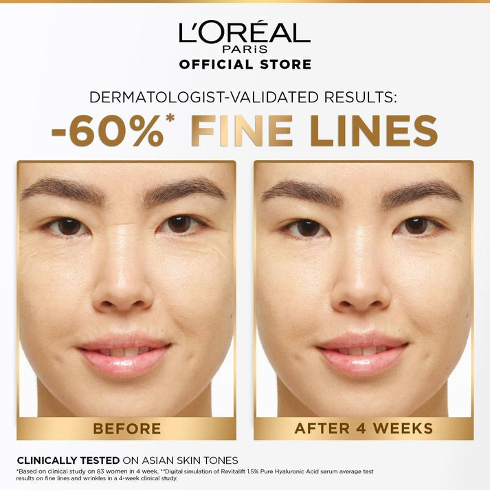 L’Oreal Serum with 1.5 % Hyaluronic Acid (15ml) for all Skin types