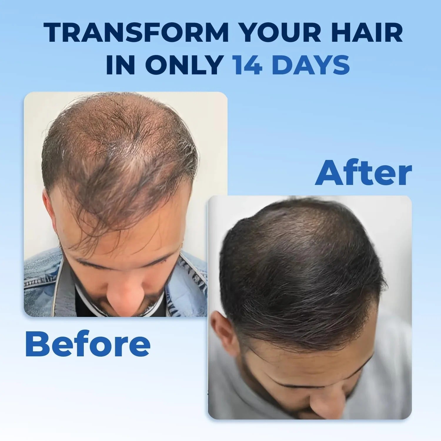 FEG Plus Hair Growth Serum